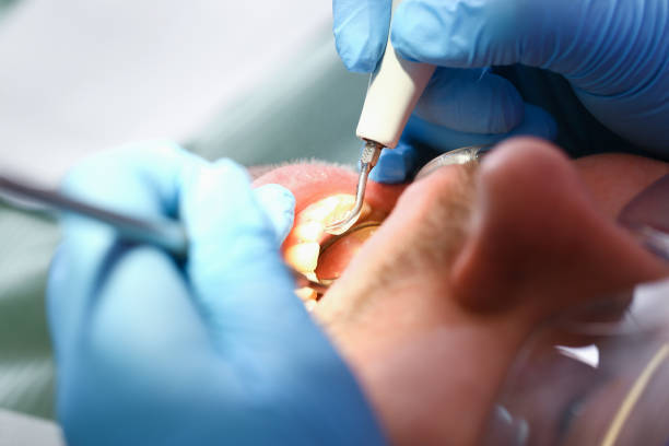 Best Root Canal Emergency Dentist  in Whitehouse, OH