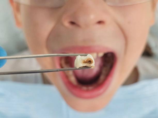 Best Broken Tooth Emergency  in Whitehouse, OH